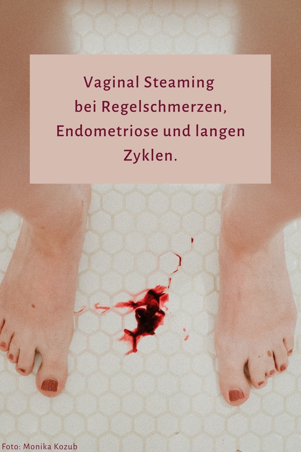 Vaginal Steaming Austria - Regelschmerzen, unregelmäßige Zyklen und Endometriose